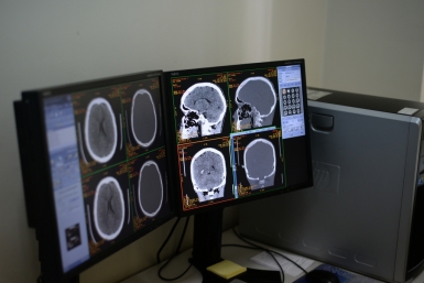 Аппарат МРТ Алексей Тимиргалеев